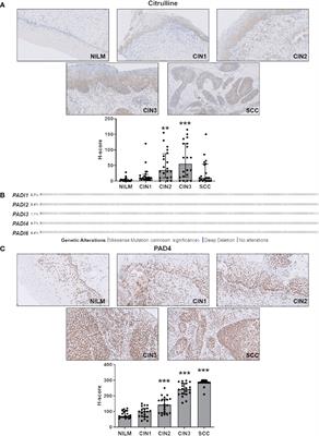 PAD-mediated citrullination is a novel candidate diagnostic marker and druggable target for HPV-associated cervical cancer